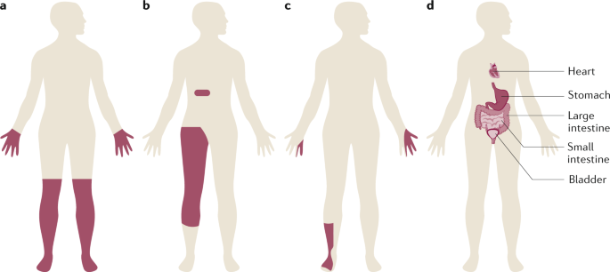 41572_2019_92_Fig1_HTML.png
